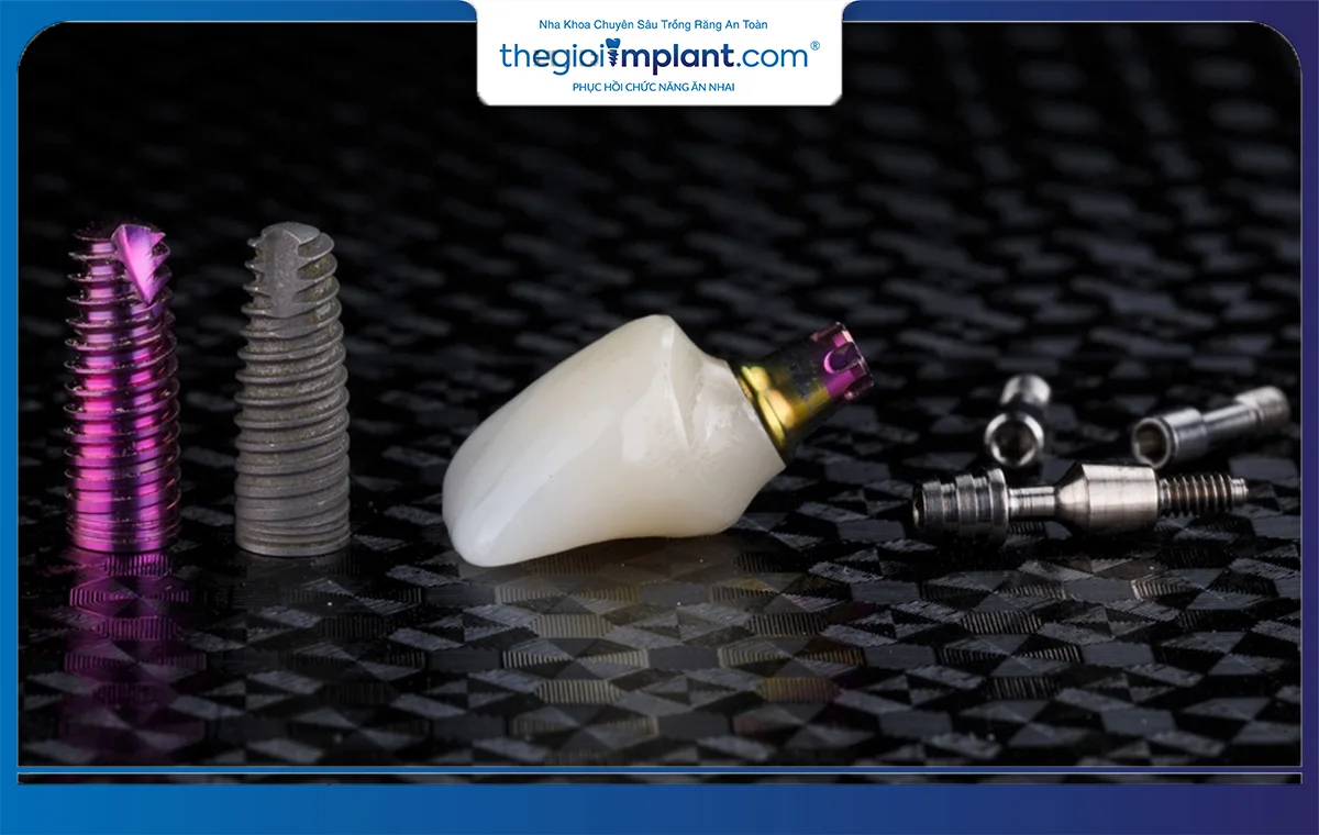 So sánh khách quan những đặc điểm của cầu răng sứ và implant