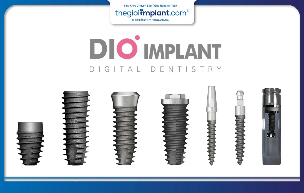 Implant Dio là một thương hiệu sản xuất trụ implant uy tín đến từ Hàn Quốc