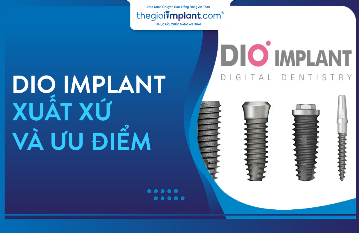 implant dio thumbnail