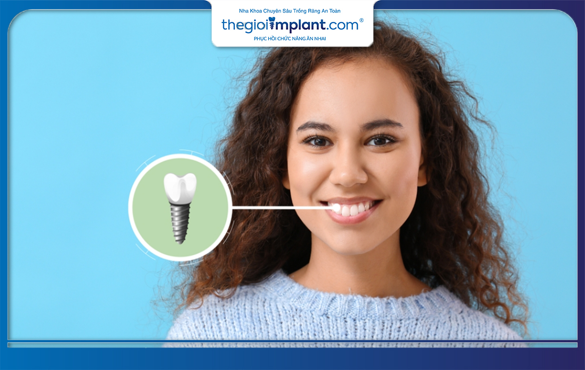 Các dòng trụ implant từ Mỹ luôn được ưa chuộng bởi chất lượng đảm bảo