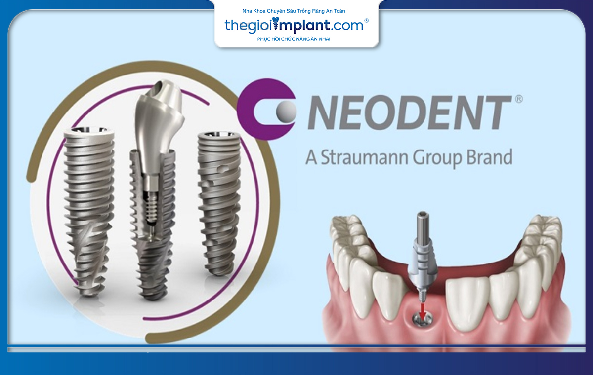 Implant Neodent - một trong những dòng trụ cao cấp hàng đầu