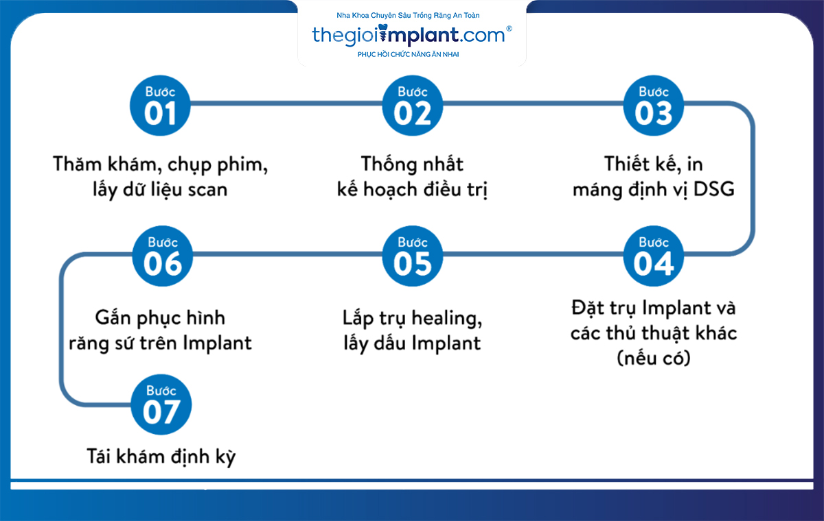 Quy trình trồng răng 7 bước chuẩn y khoa tại thegioiimplant.com