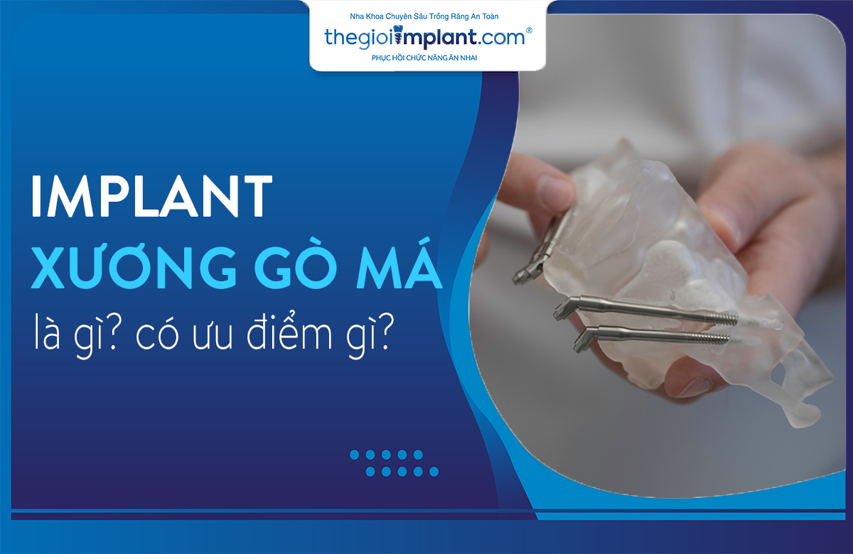 implant xương gò má thumbnail