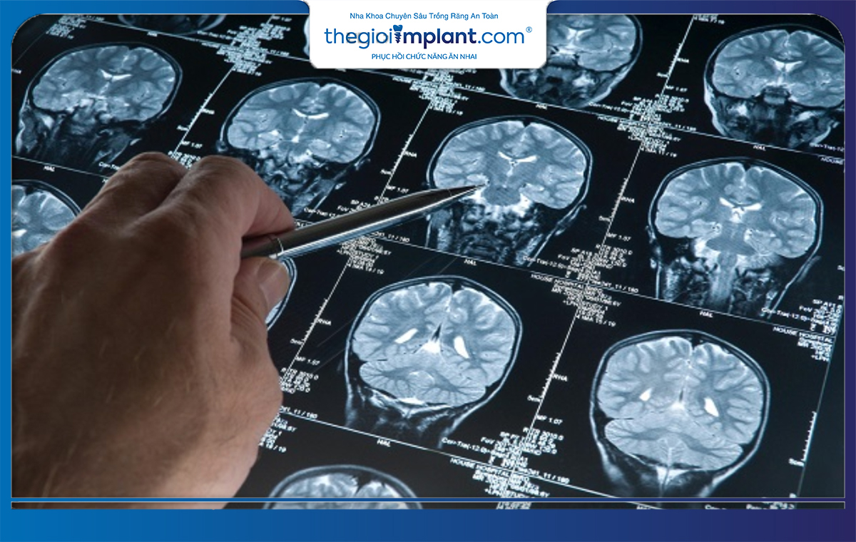 Kết quả ảnh chụp sắc nét từ máy MRI