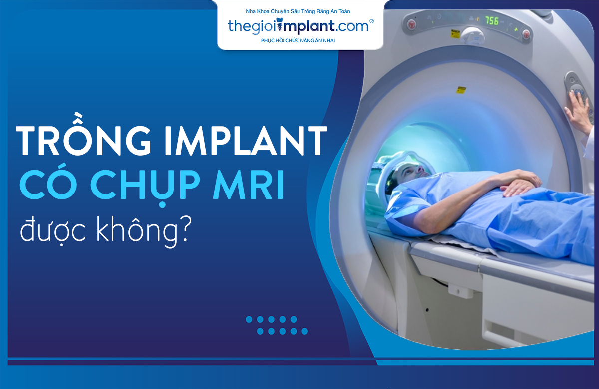 trồng răng implant có chụp mri được không thumbnail