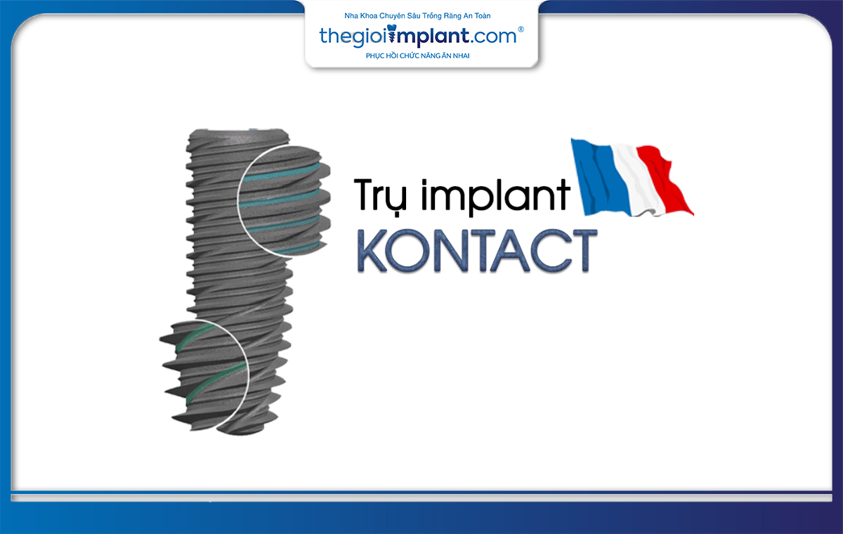 Trụ implant Kontact có xuất xứ từ Pháp