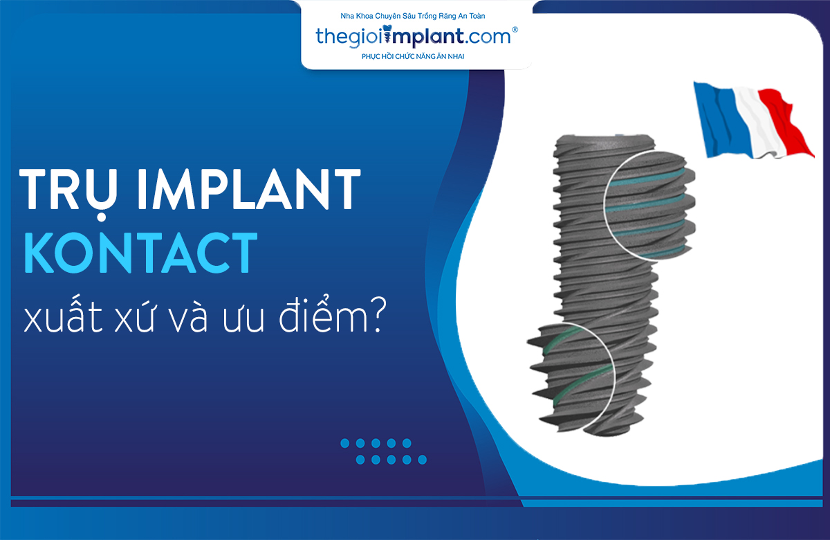 trụ implant kontact thumbnail