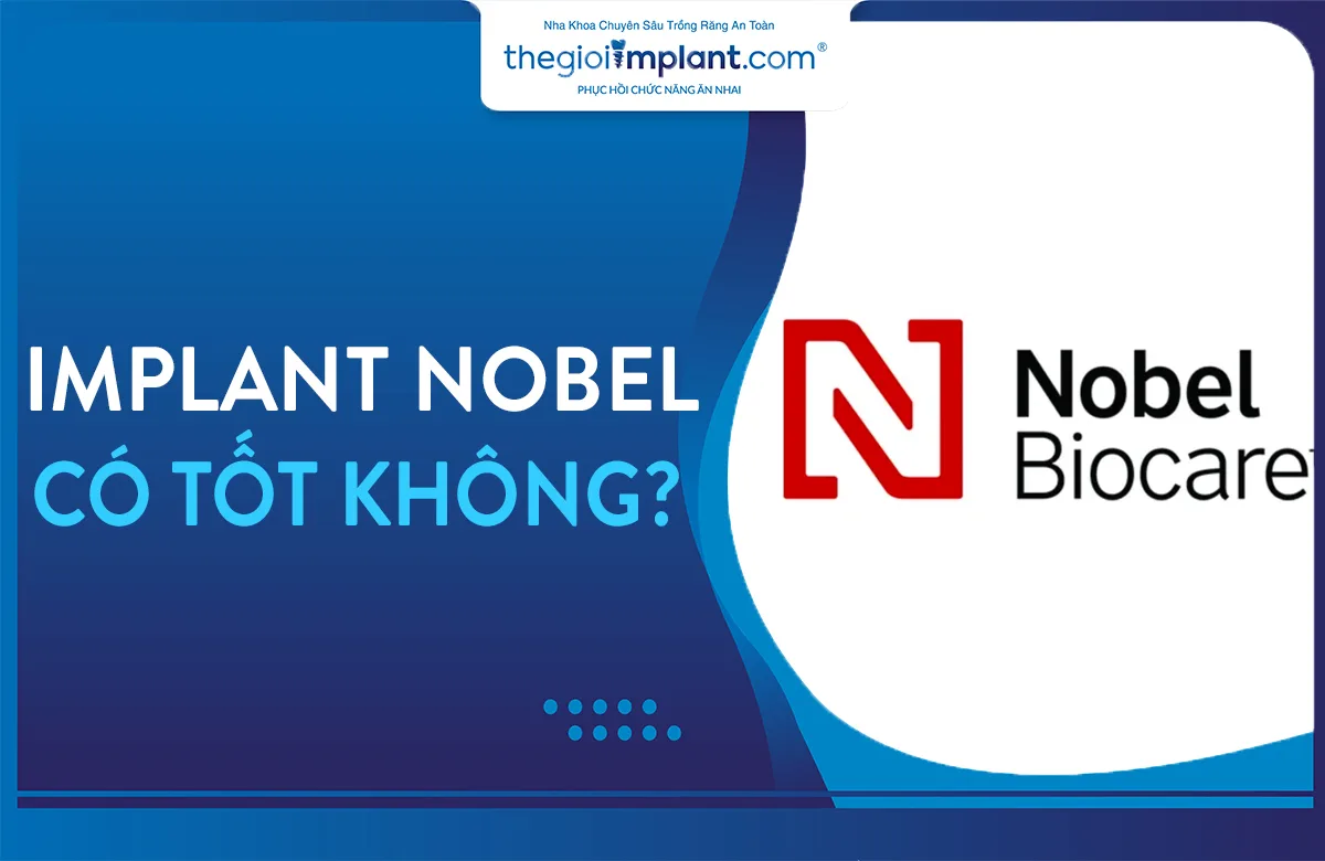 Trụ implant Nobel Biocare