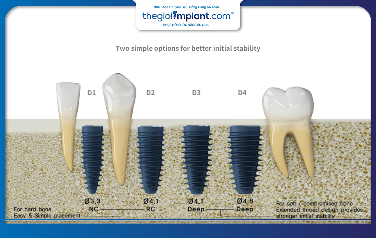 Các dòng trụ implant Megagen với đa dạng các kích thước khác nhau