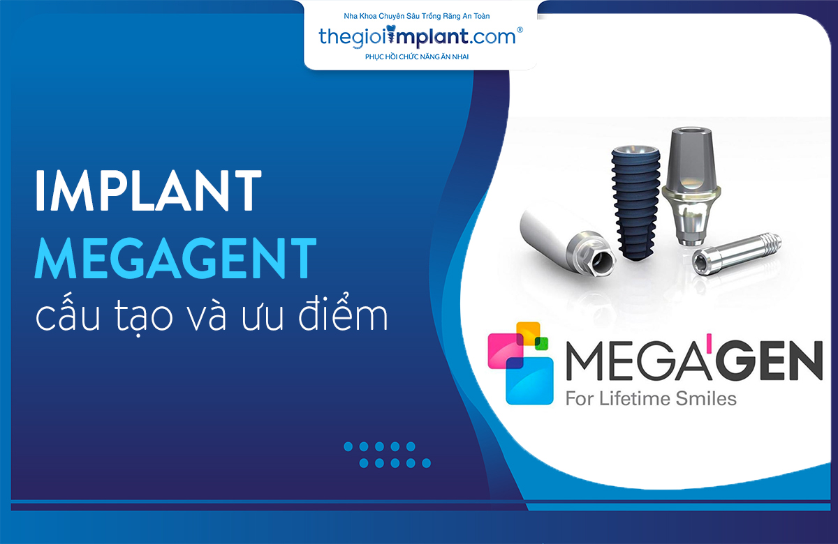 implant megagent thumbnail