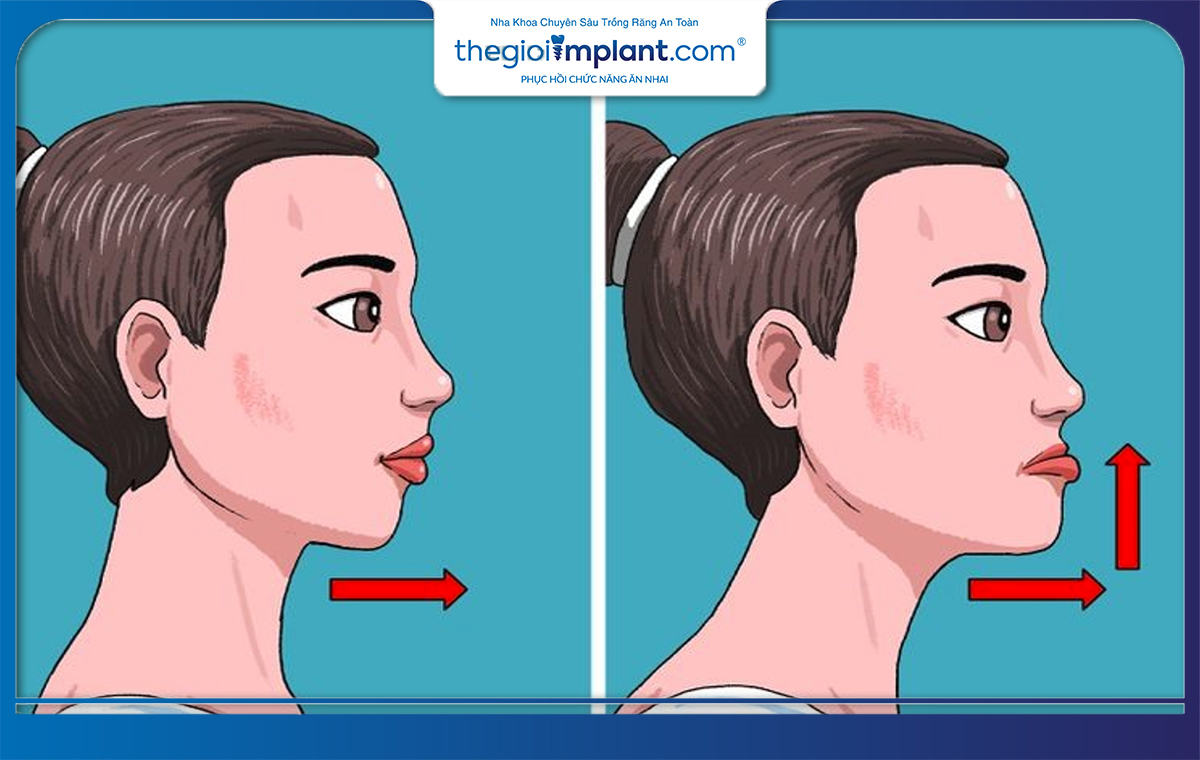 Jawline là gì? Tìm hiểu về đường viền hàm và cách cải thiện