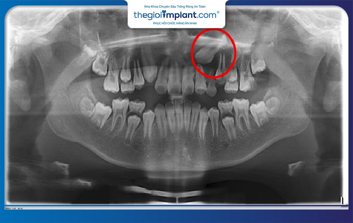 Bác sĩ sẽ kết luận tình trạng thông qua các phương pháp chẩn đoán hình ảnh