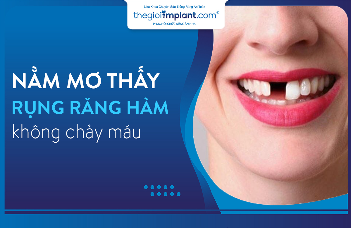 nằm mở thấy rụng răng hàm trên không chảy máu