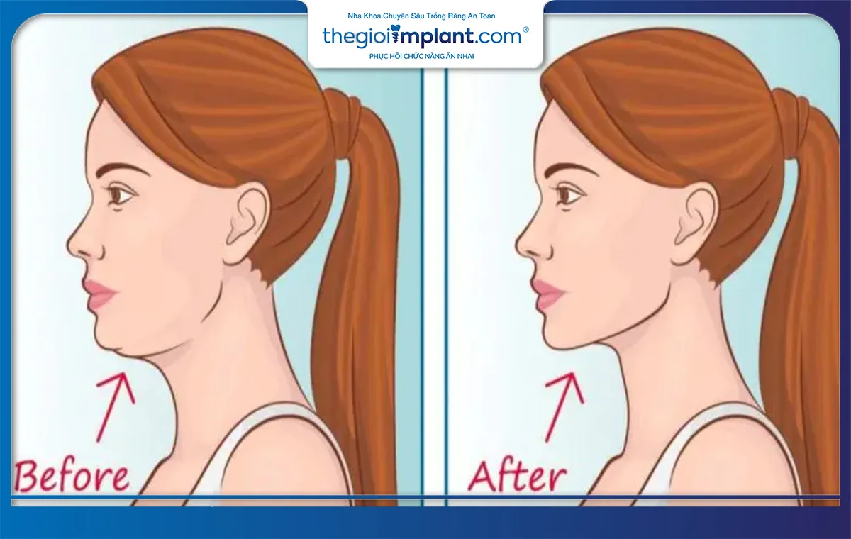 Tập đặt lưỡi đúng vị trí sẽ mang lại nhiều lợi ích