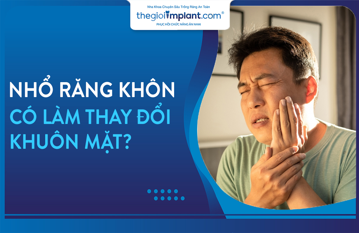 Thumnail nhổ răng khôn có làm thay đổi khuôn mặt