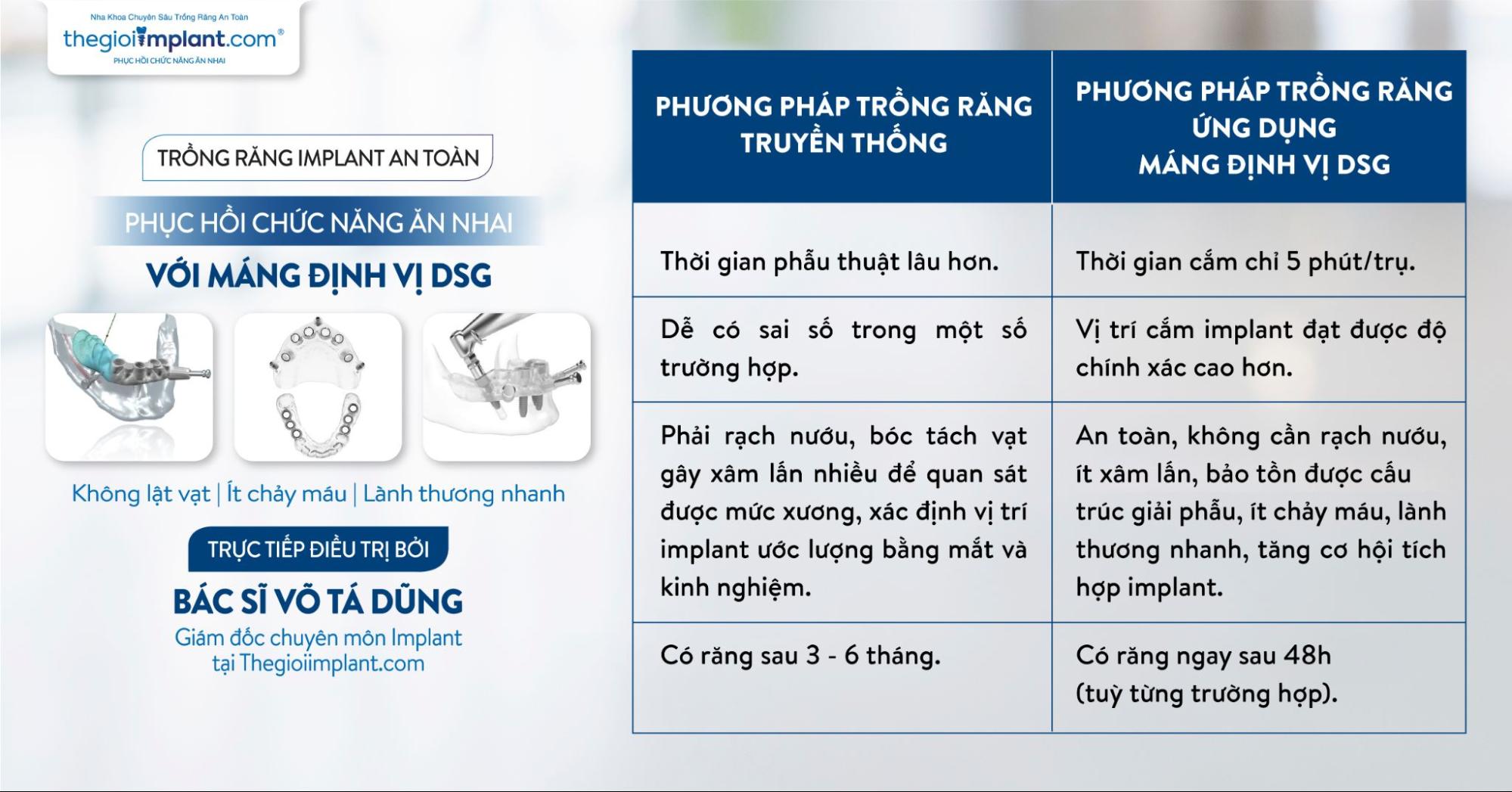 Công nghệ máng định vị DSG hiện đại giúp quá trình trồng răng được chính xác hơn