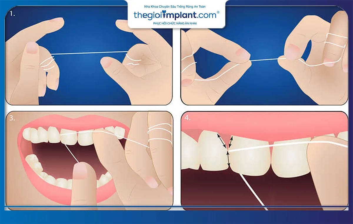 Sử dụng chỉ nha khoa vệ sinh răng miệng
