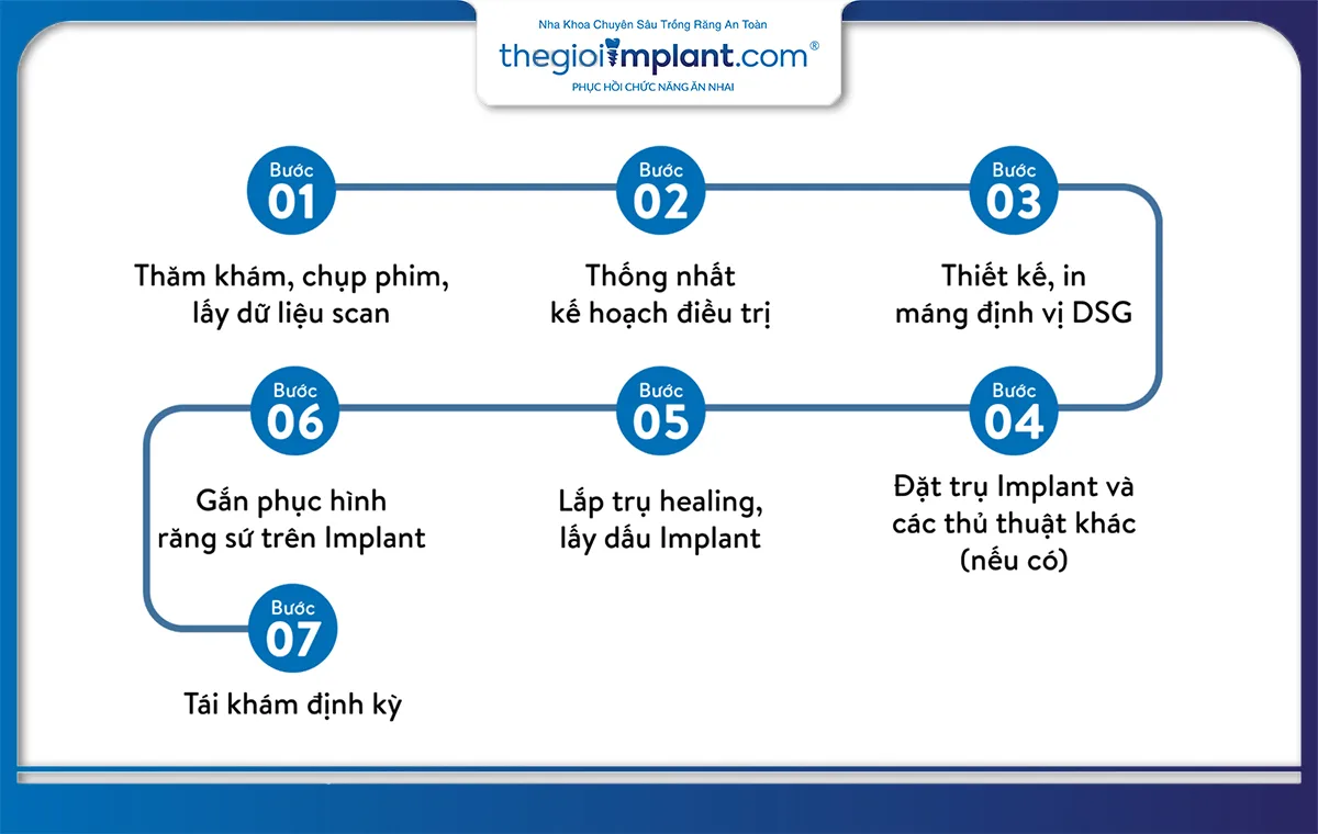 Quy trình trồng răng implant all on 6 7 bước chuẩn y khoa