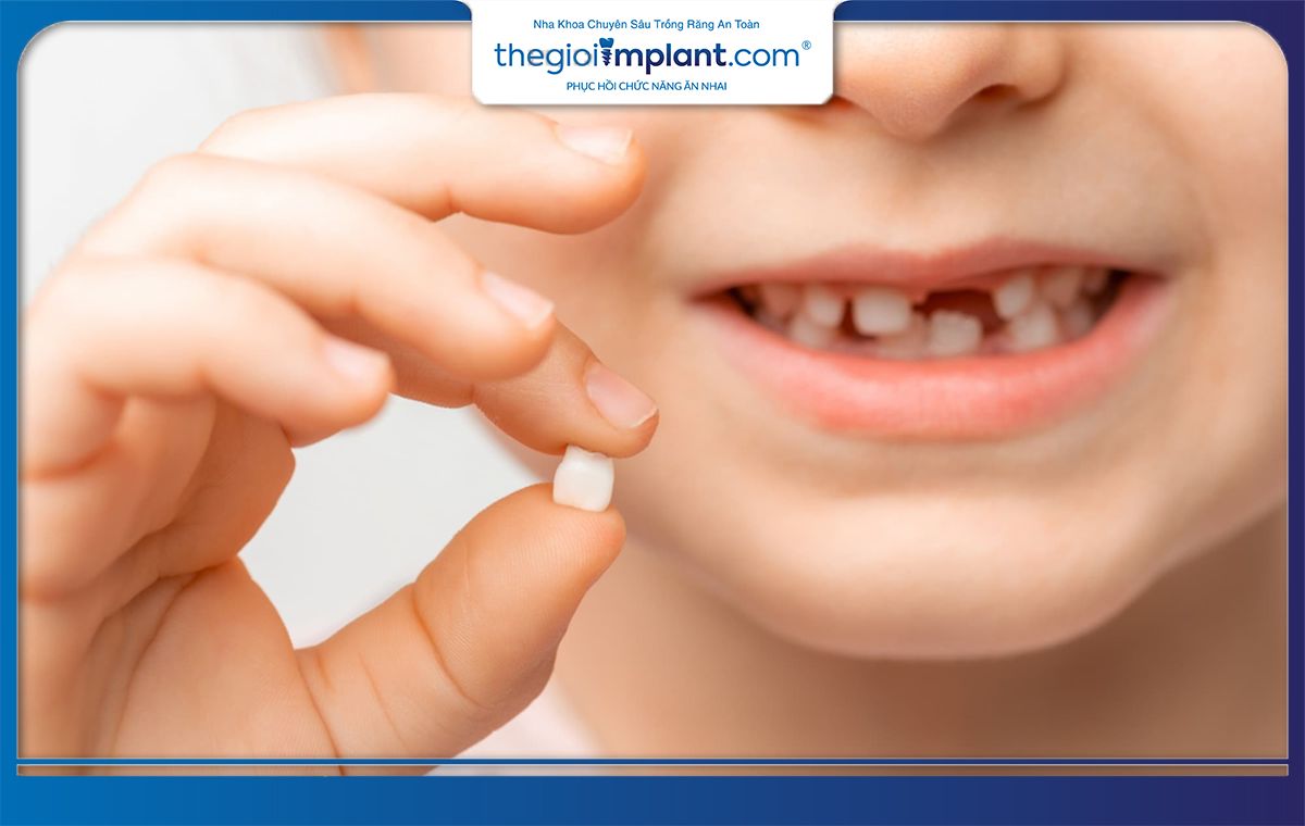 Trẻ em dưới 18 tuổi không nên trồng răng Implant