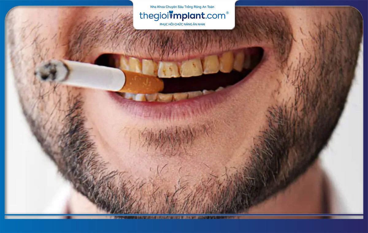 Không nên trồng răng Implant đối với người nghiện thuốc lá