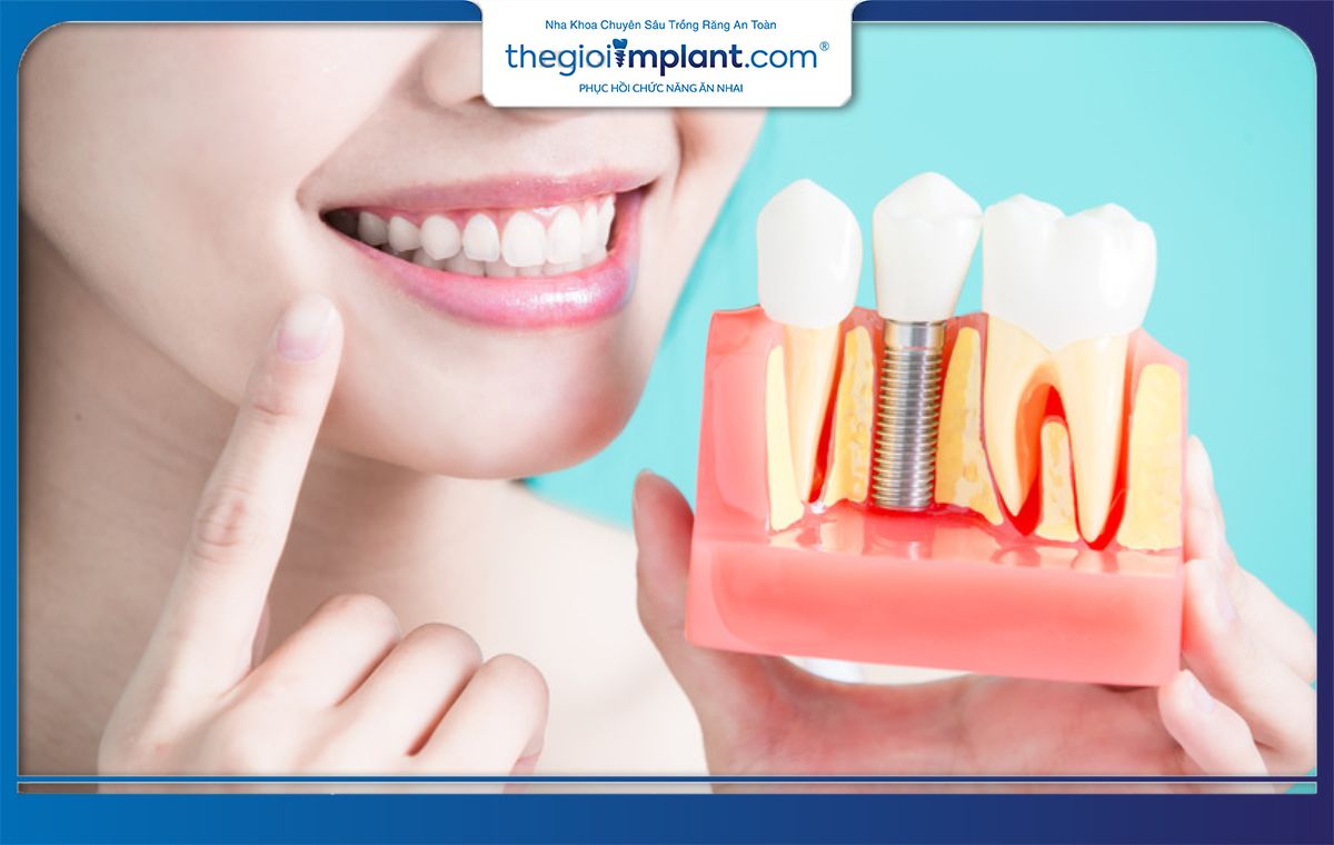 Lợi ích của trồng răng Implant hàng đầu là chắc khoẻ như răng thật