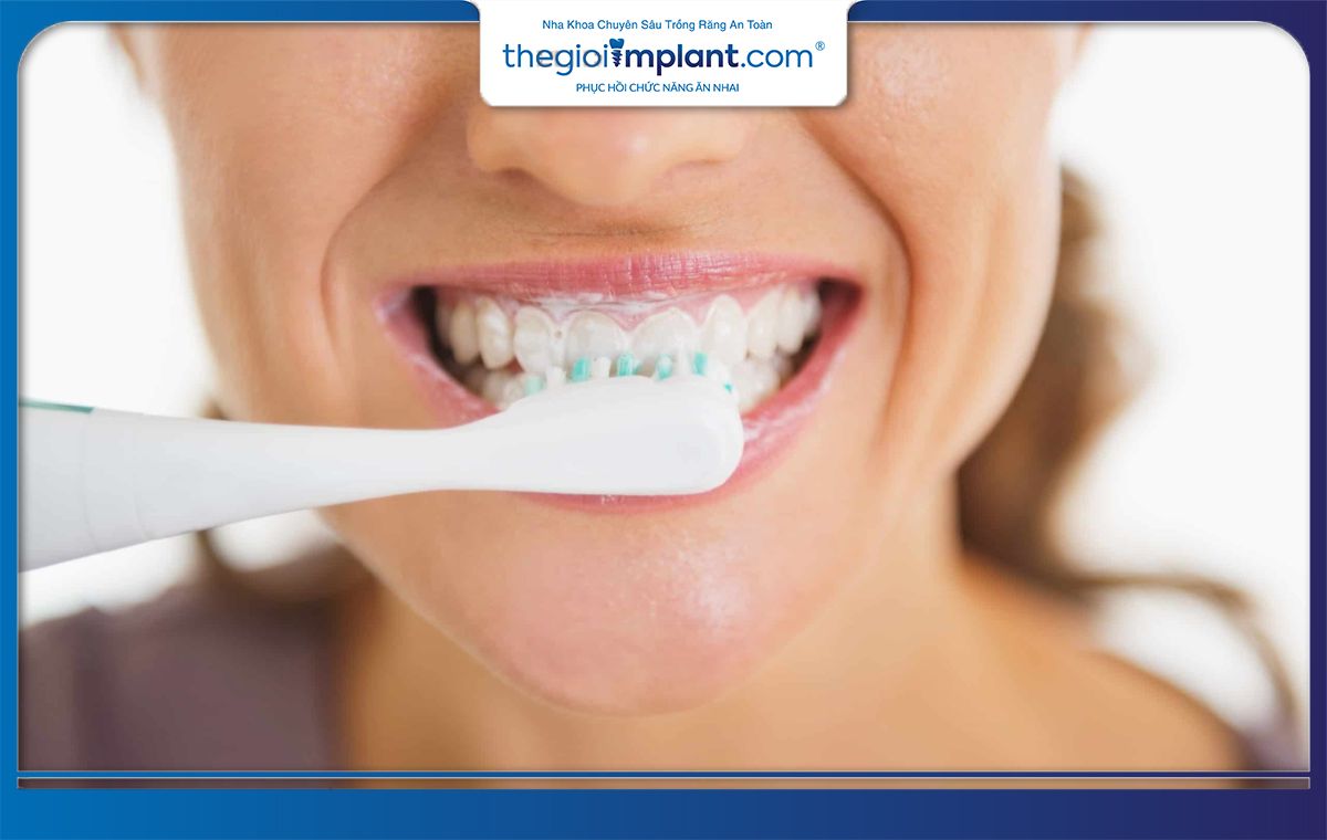 Vệ sinh răng miệng nhẹ nhàng sau khi trồng Implant