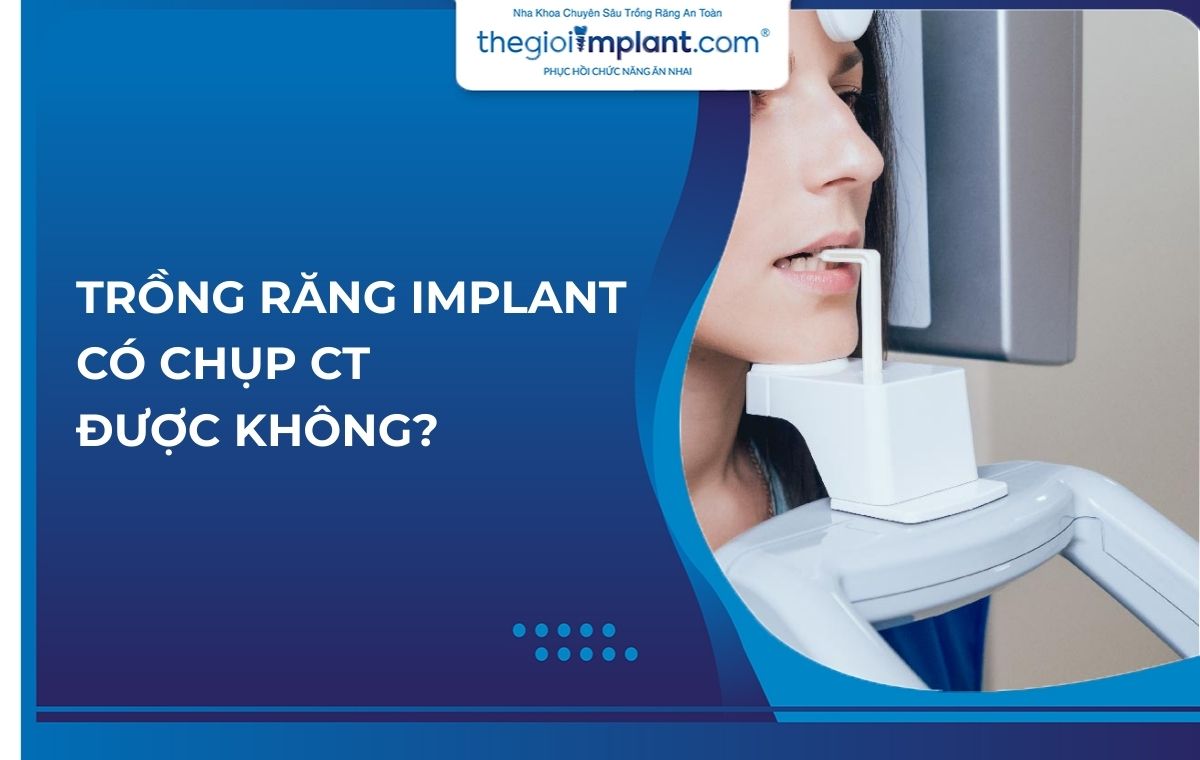 Trồng răng implant có chụp CT được không?