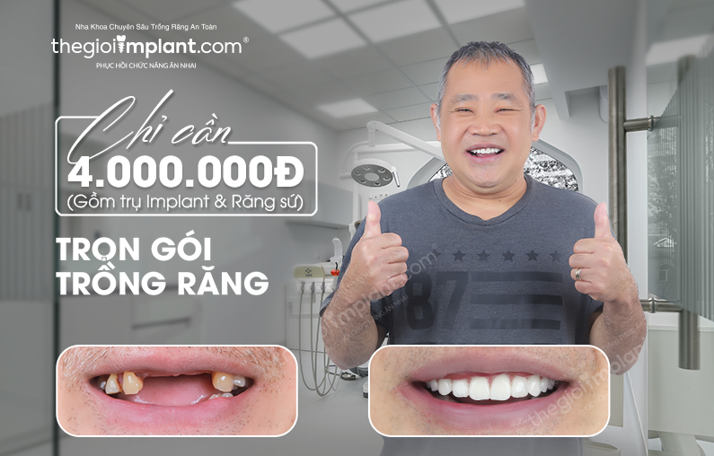 Nha khoa Thegioiimplant.com “tái sinh nụ cười” chỉ cần 4 triệu đồng