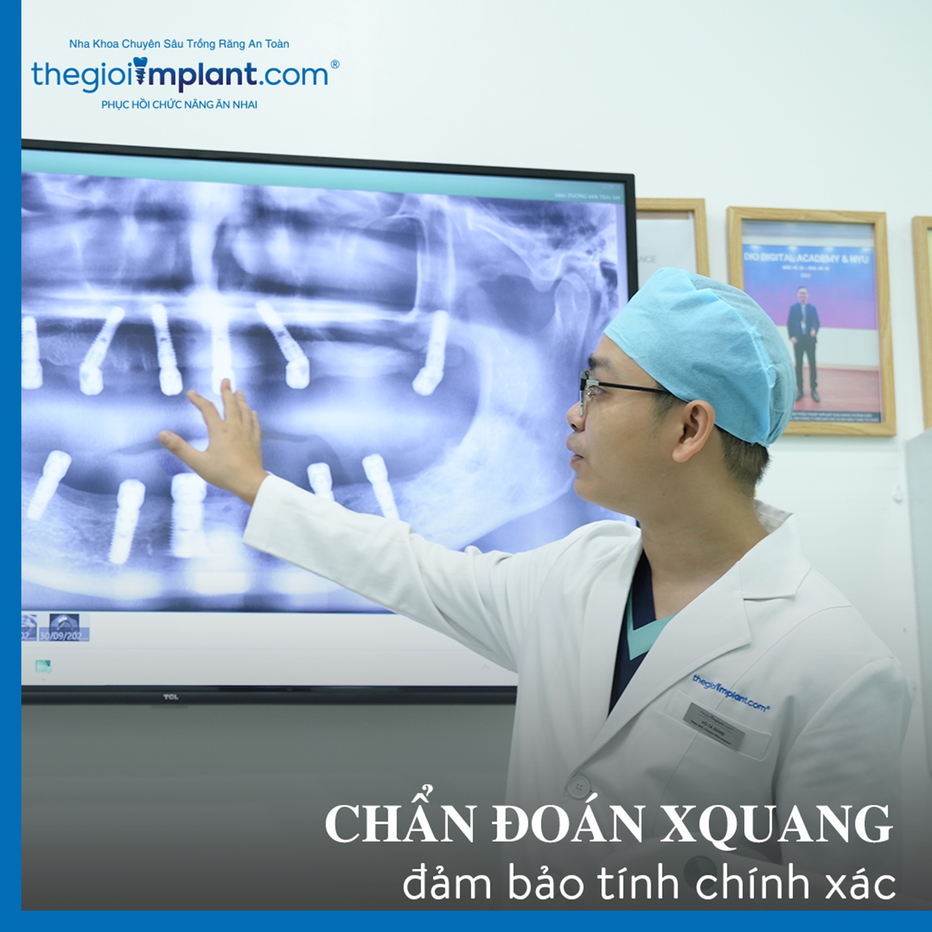 Khách hàng sau khi trồng răng Implant