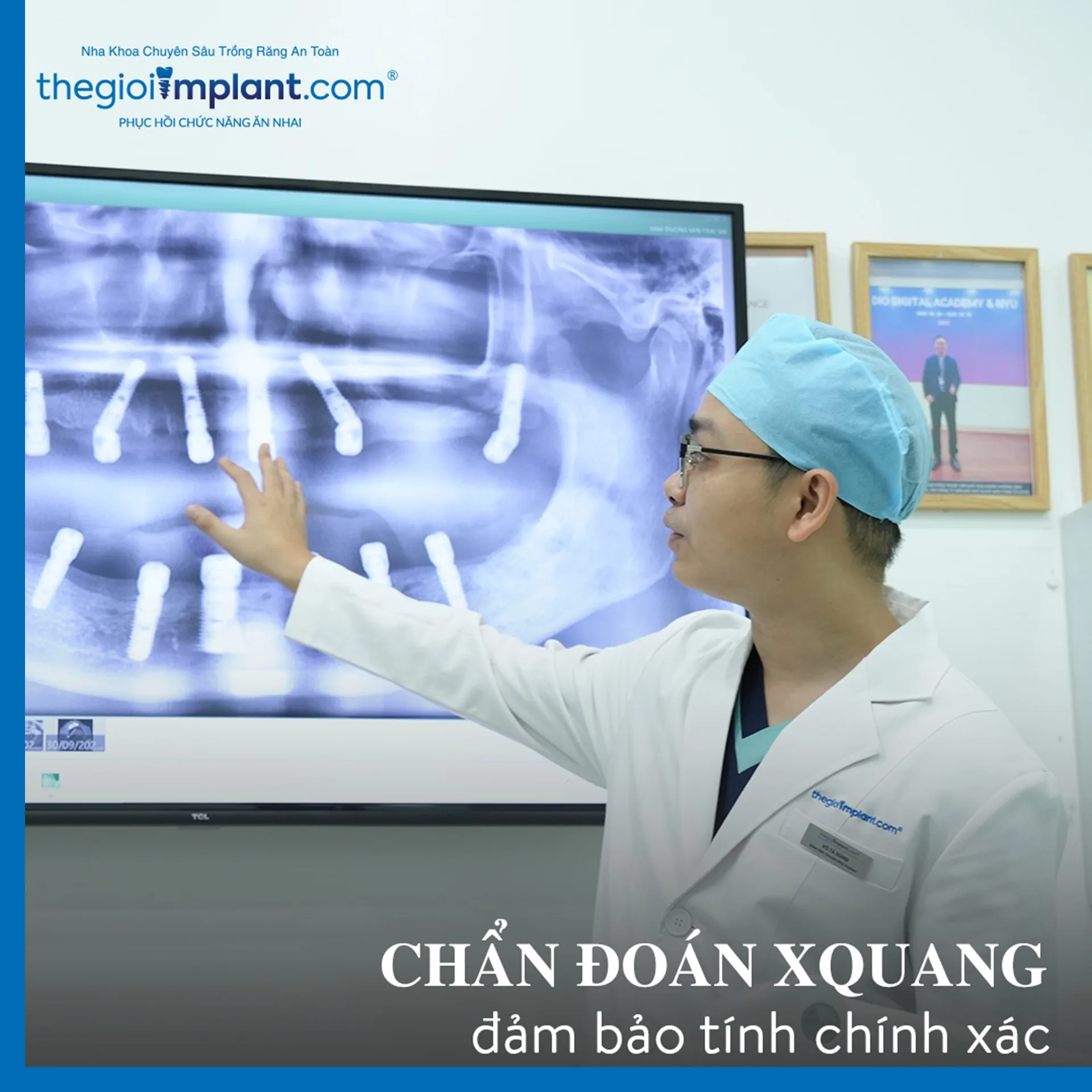 Khách hàng sau khi trồng răng Implant