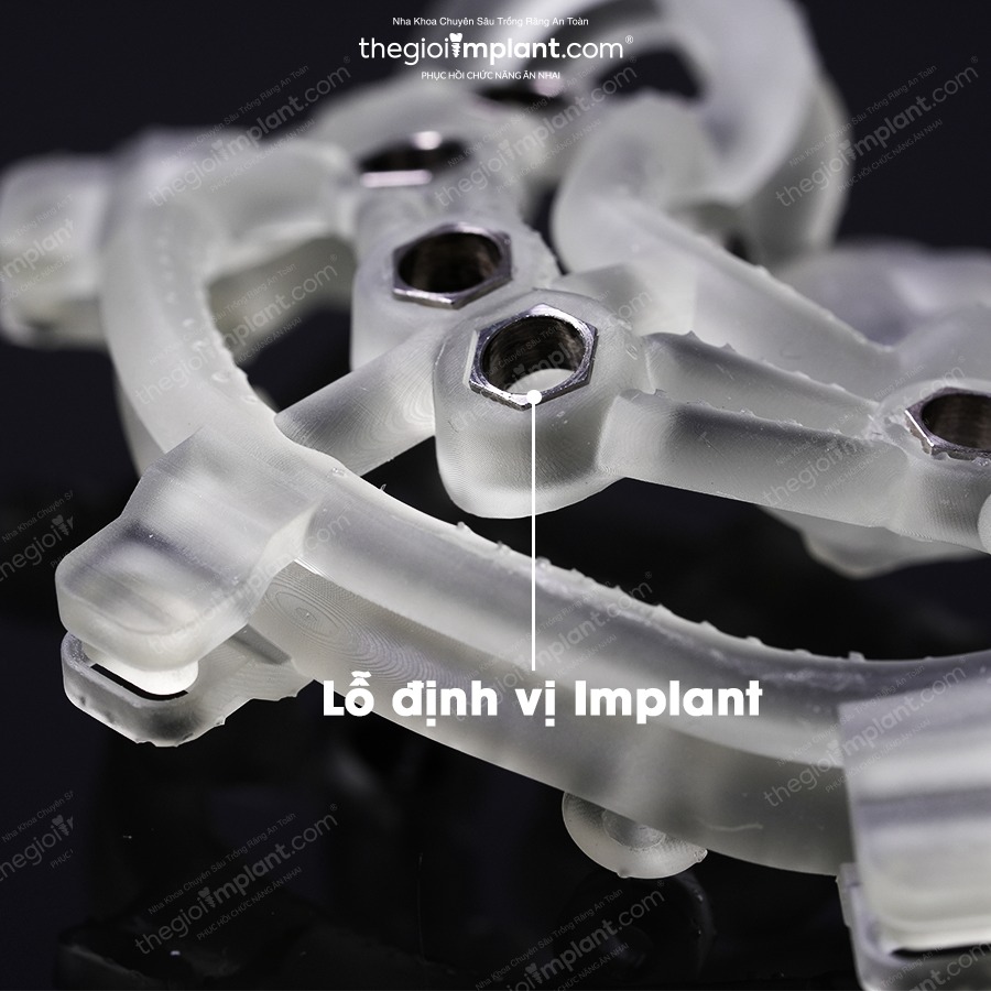 Máng định vị DSG