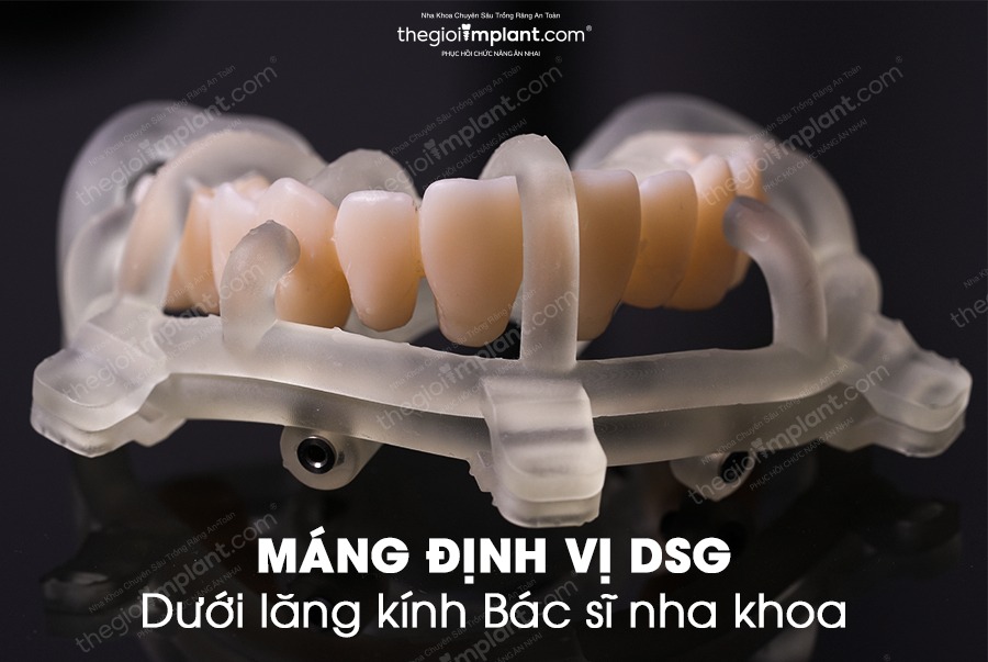 Có răng ngay sau 6 giờ
