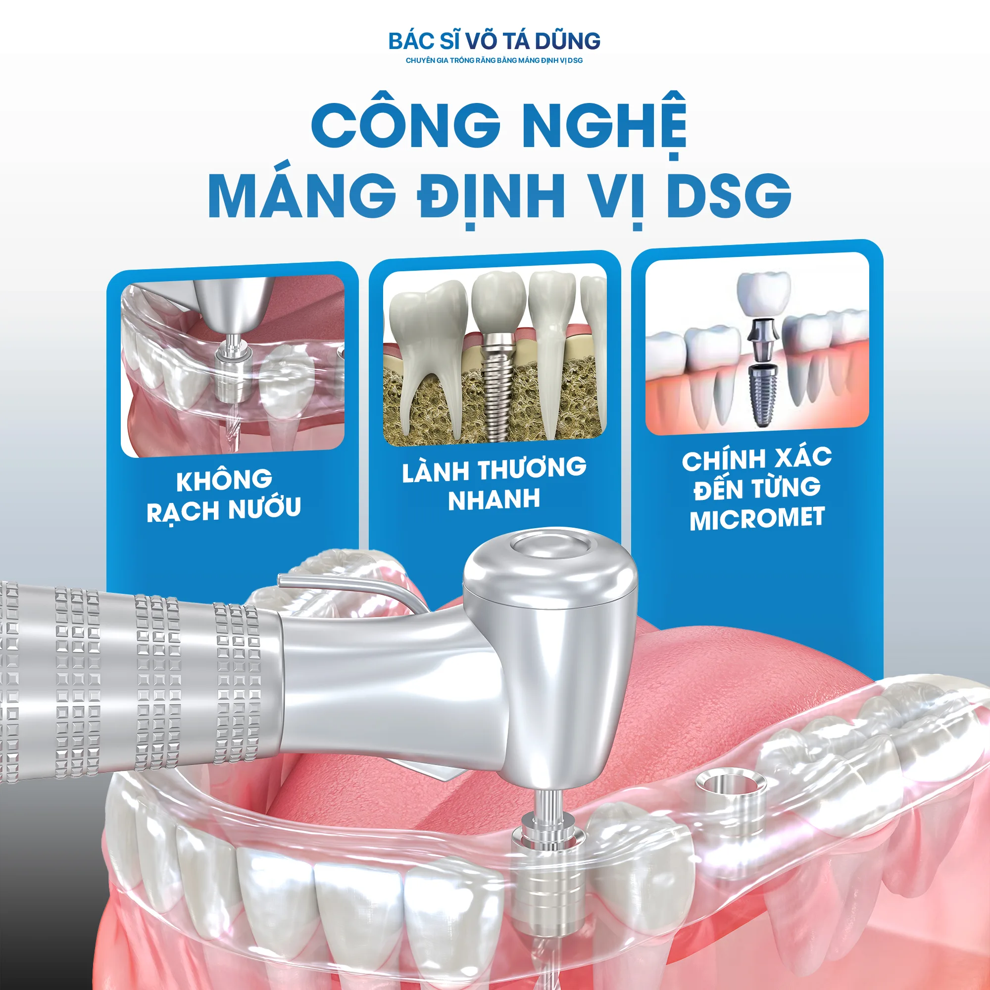 implant có đau không - hình 6
