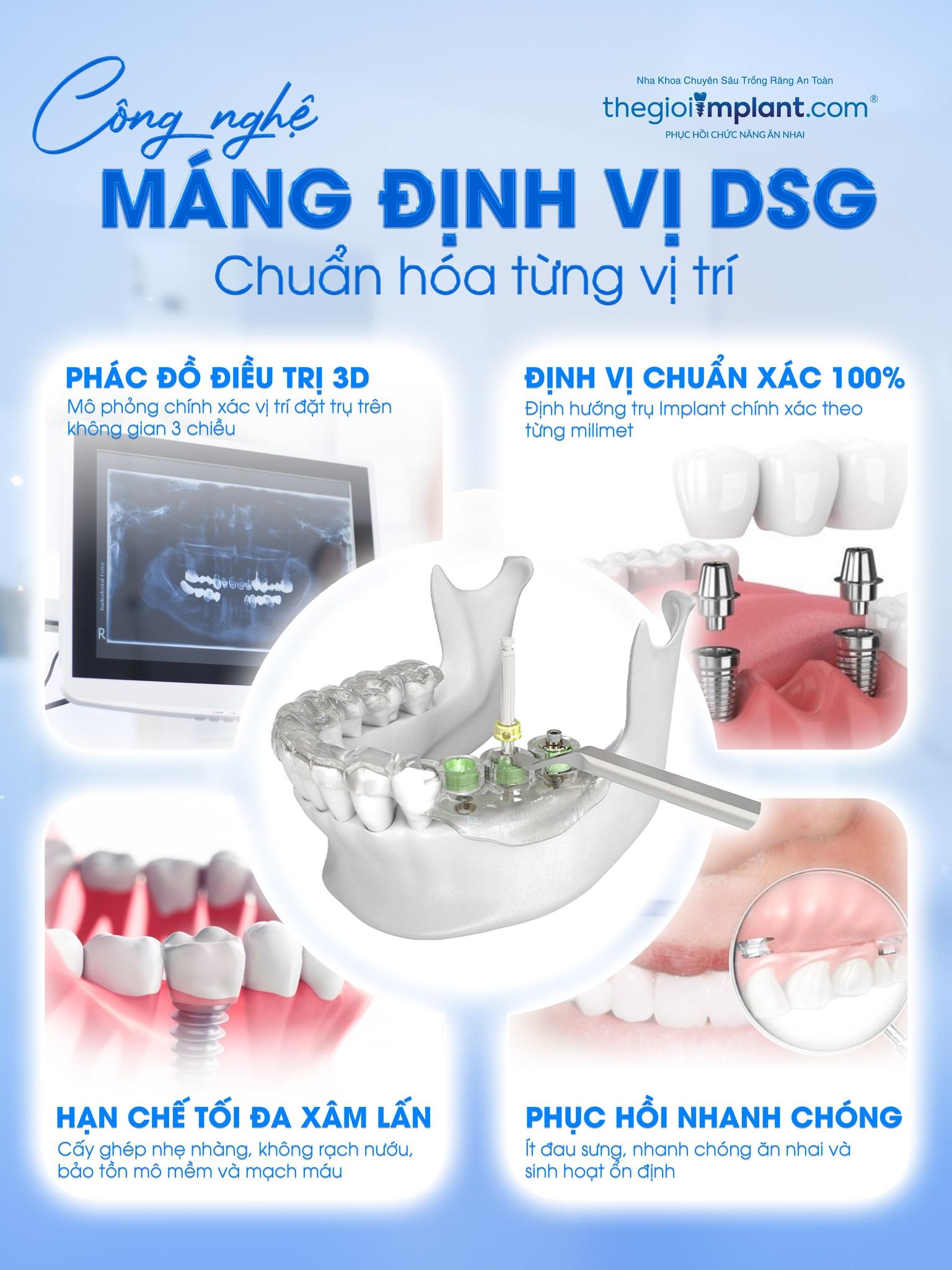 giá trồng răng implant - hình 3