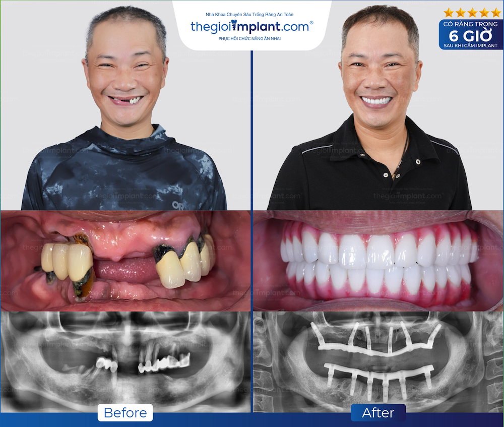 Khách hàng Thegioiimplant.com
