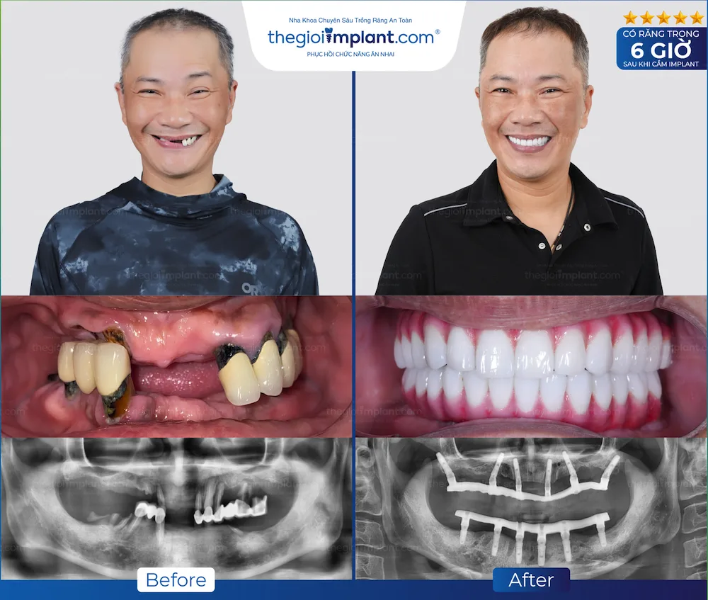 Khách hàng Thegioiimplant.com