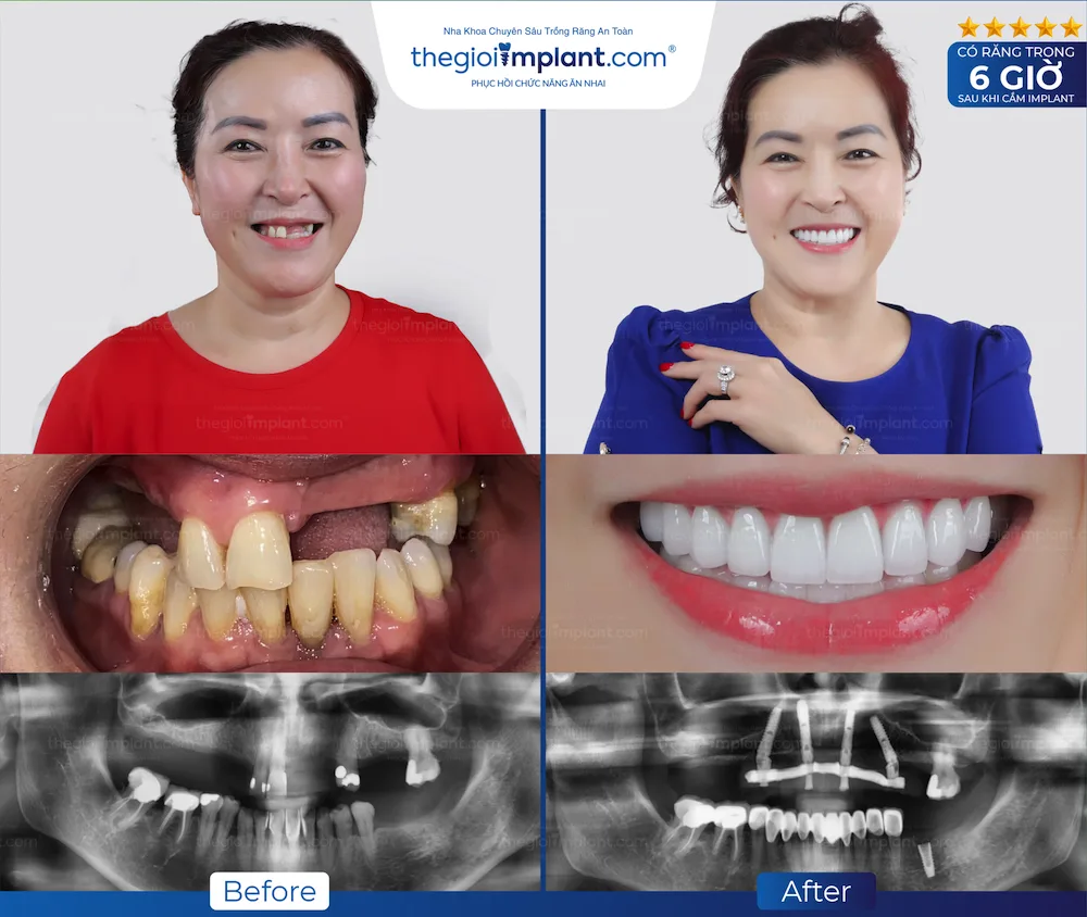 Khách hàng Thegioiimplant.com