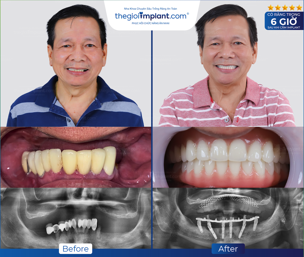 Khách hàng Thegioiimplant.com