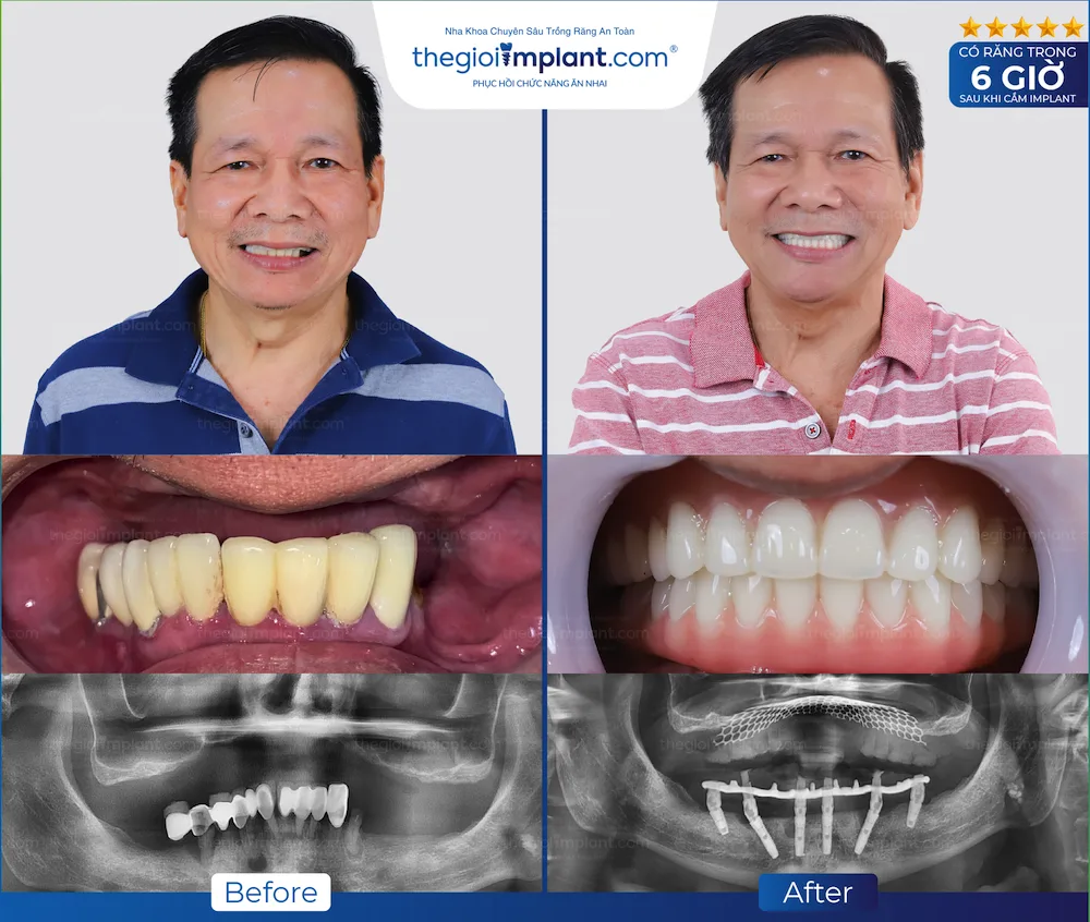 Khách hàng Thegioiimplant.com