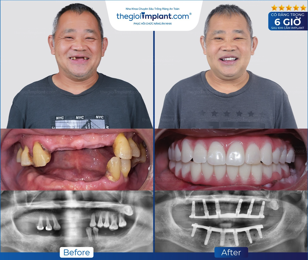 Khách hàng Thegioiimplant.com