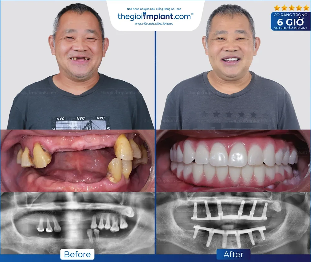 Khách hàng Thegioiimplant.com