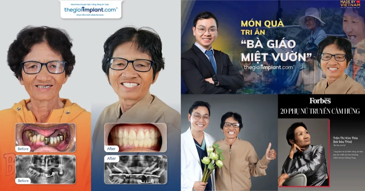 Bà Sáu Thia - Top 20 phụ nữ truyền cảm hứng Forbes 2021, ca Implant phức tạp thành công cùng BS Võ Tá Dũng