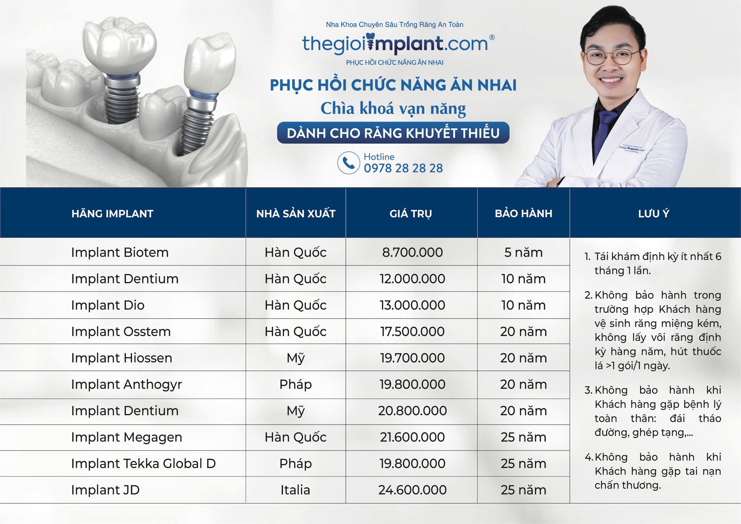Bảng giá Implant 1