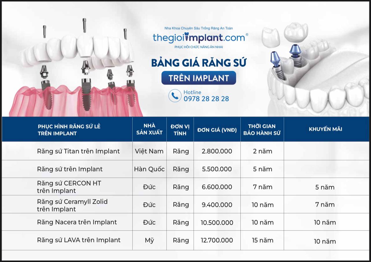 Bảng giá Implant 3