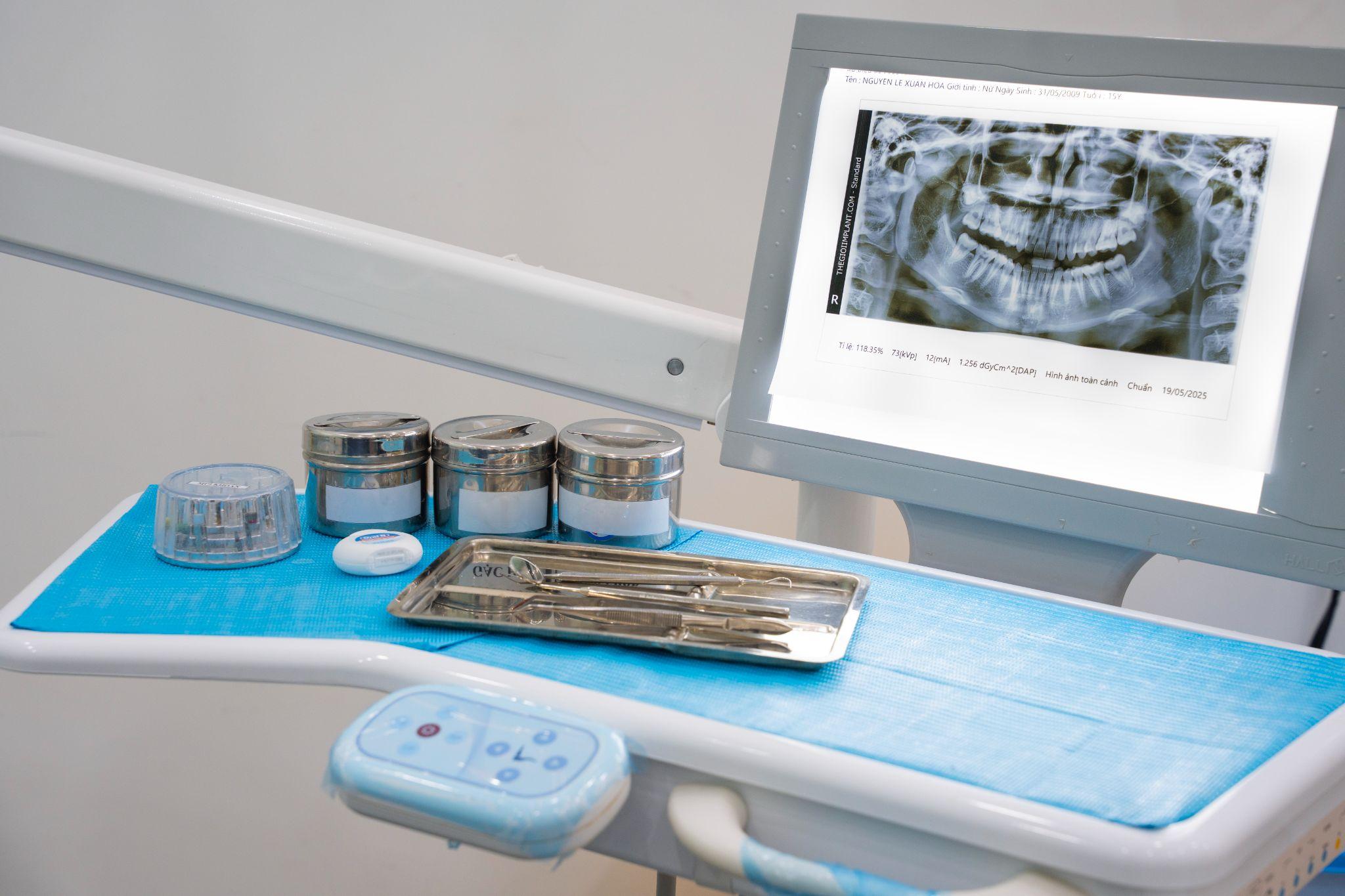 cone beam ct implant - hình 3