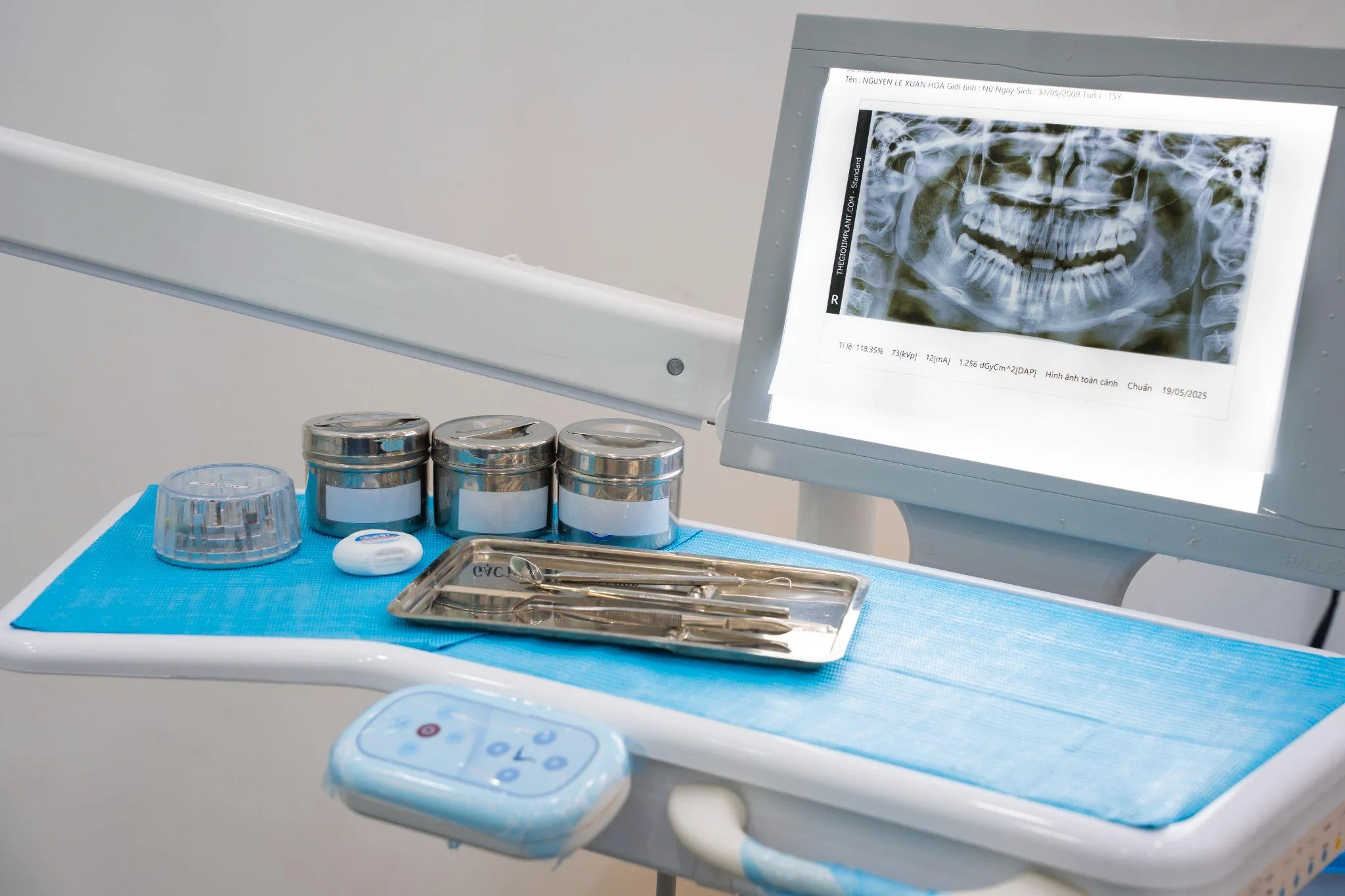cone beam ct implant - hình 3