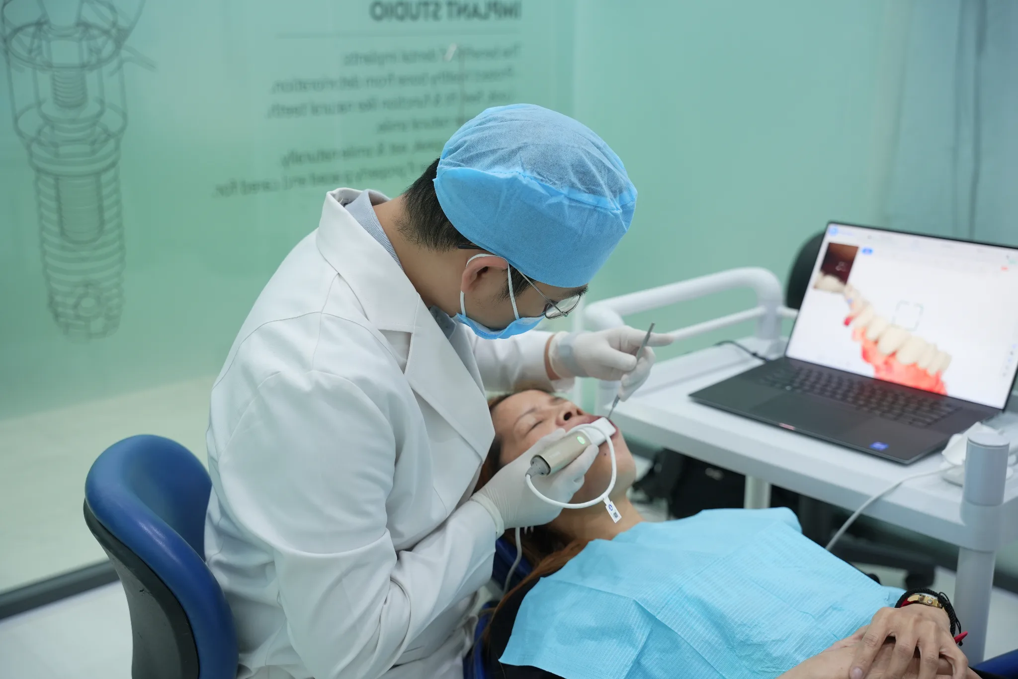cone beam ct implant - hình 5