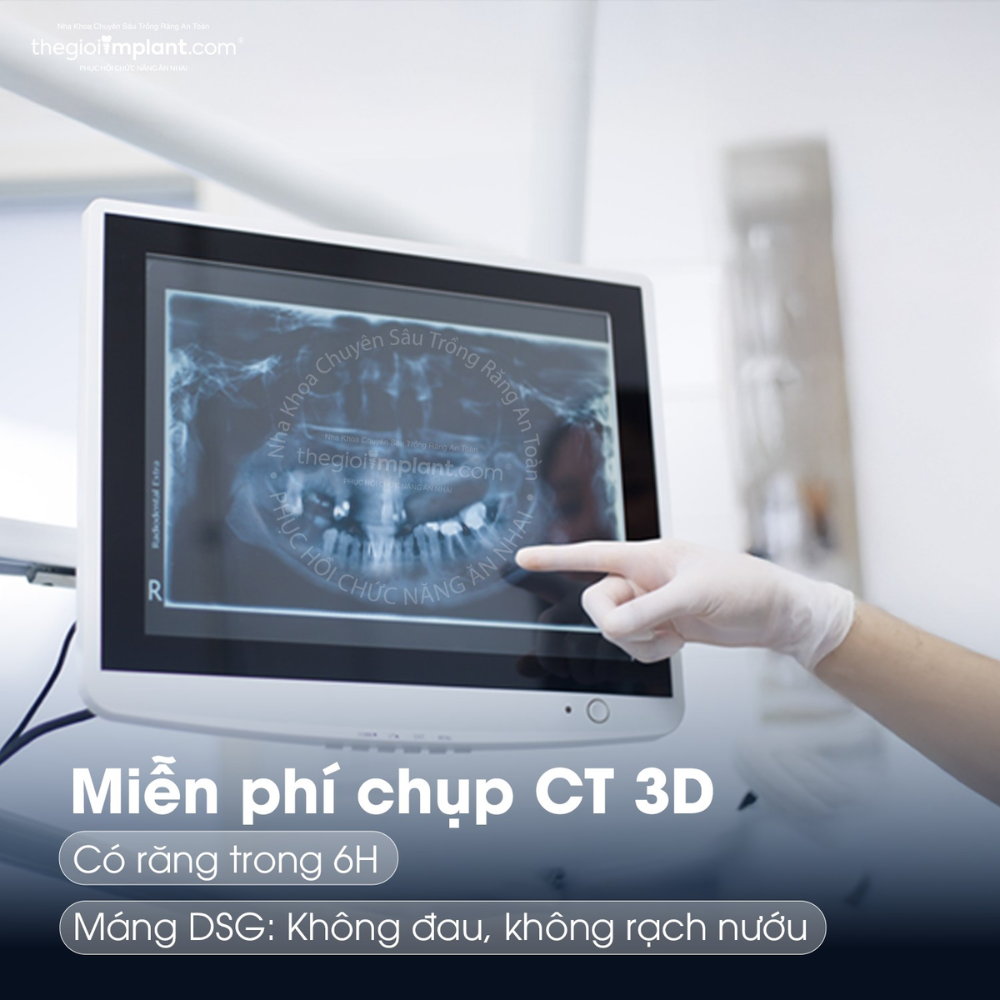 máng định vị dsg - hình 3
