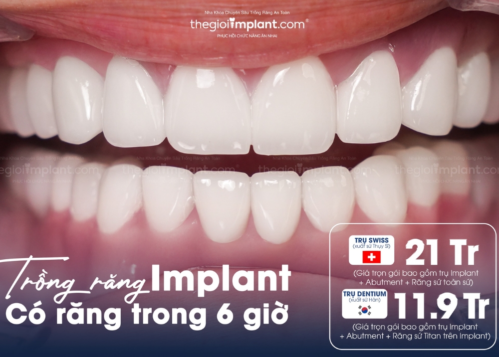răng implant dentium - hình 3