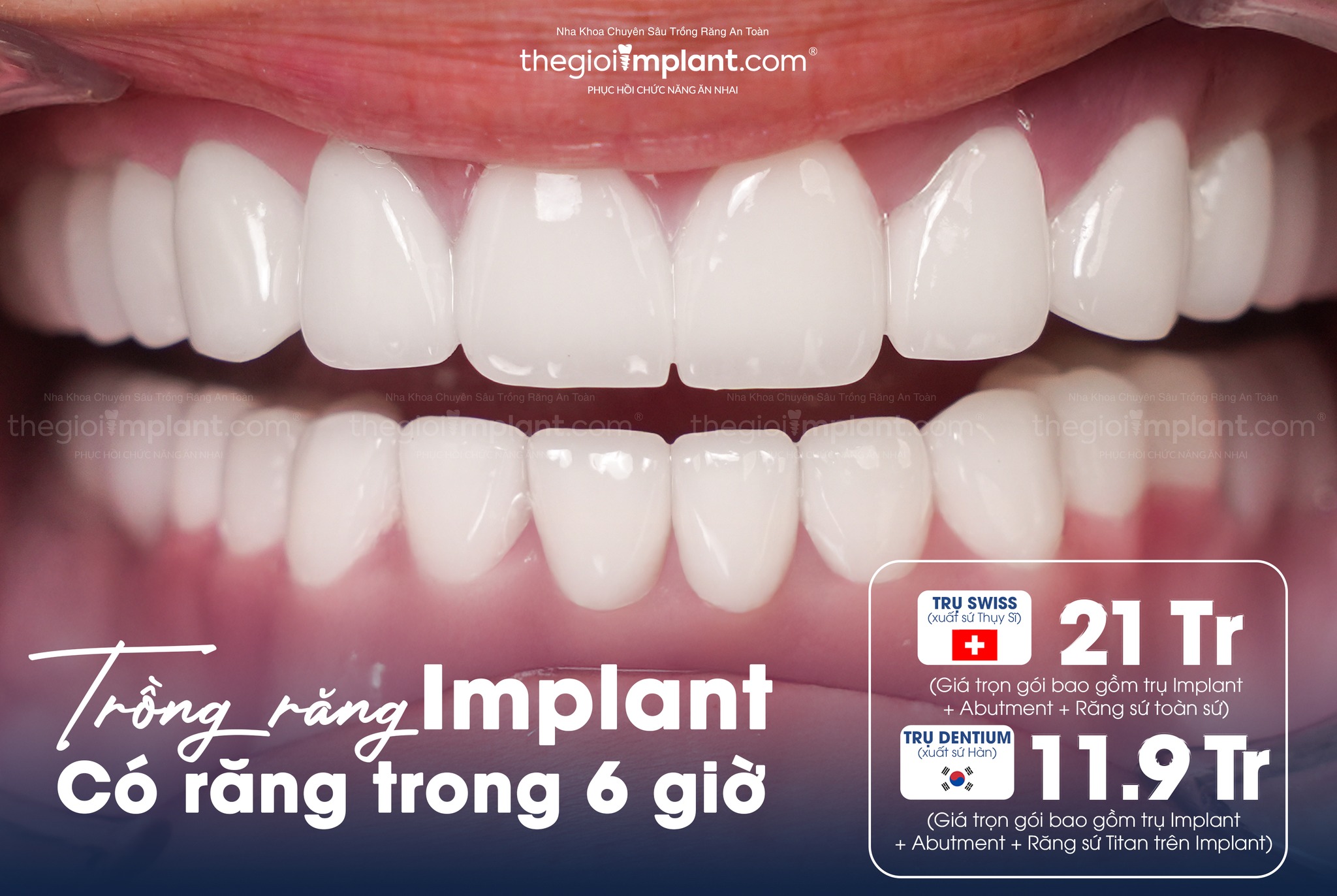 Bác sĩ Implant giỏi tphcm: 6 tiêu chí chọn đúng 2026